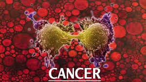 Histologie d'un cancer